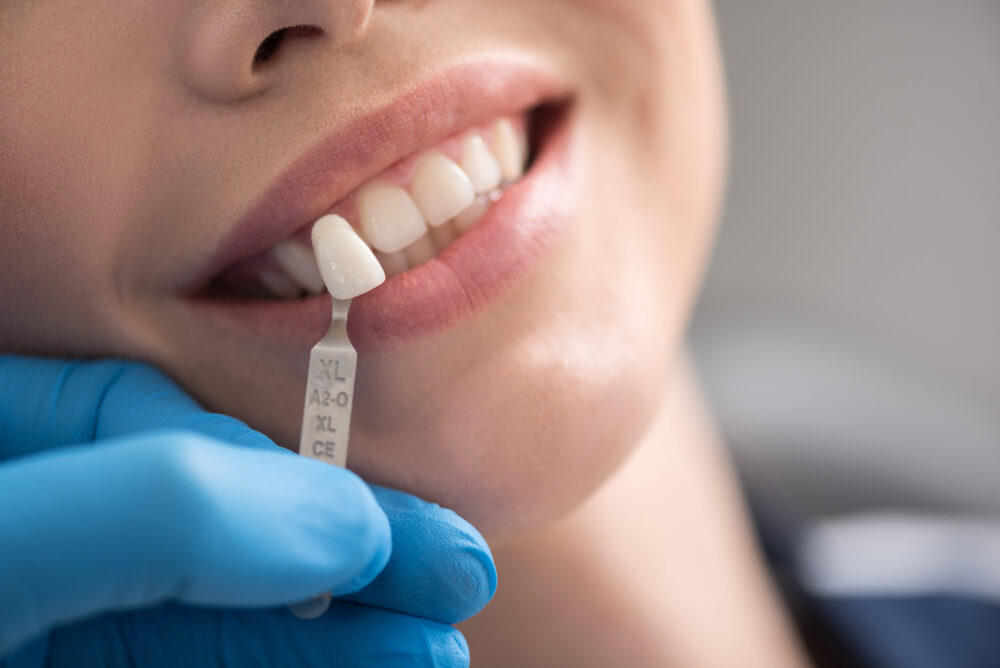 When Should You Consider Dental Crowns or Bridges? Understanding Your Restorative Options