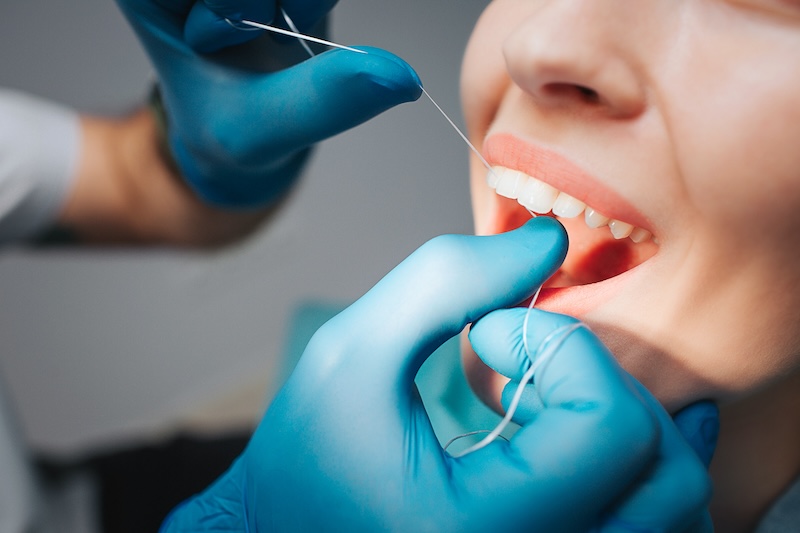 Brushing and Flossing Basics: A Step-by-Step Guide for Optimal Oral Hygiene Brushing and Flossing Basics: A Step-by-Step Guide for Optimal Oral Hygiene